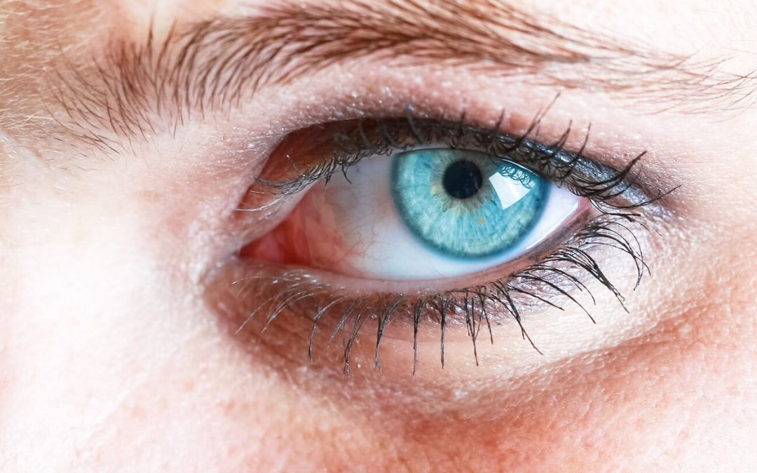 Psoriasis autour des yeux : comment le traiter ?