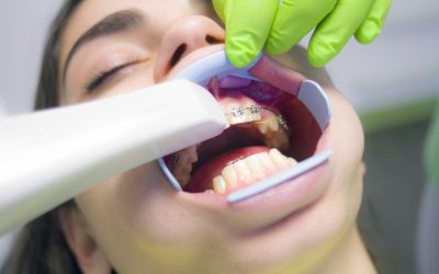 Quels sont les premiers gestes à adopter lors d’une urgence dentaire ?